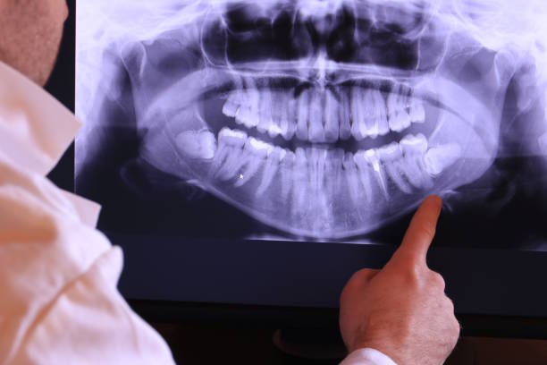 Best Broken Tooth Emergency  in Melissa, TX