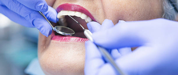 Best Dentist for Tooth Abscess  in Melissa, TX